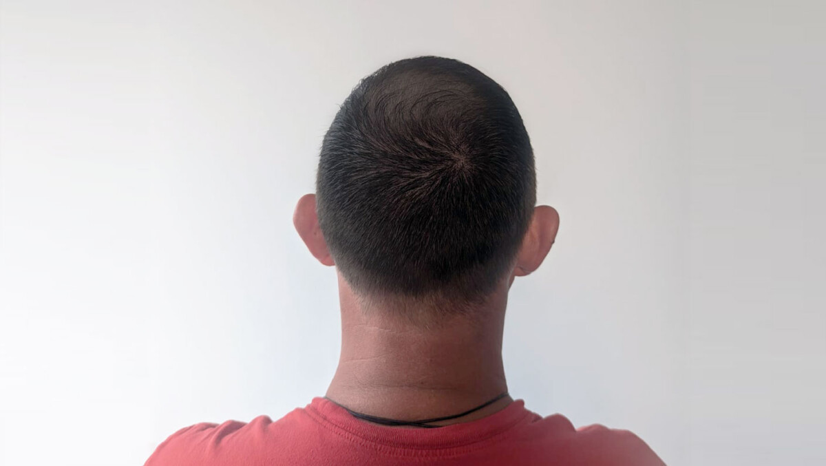 After image