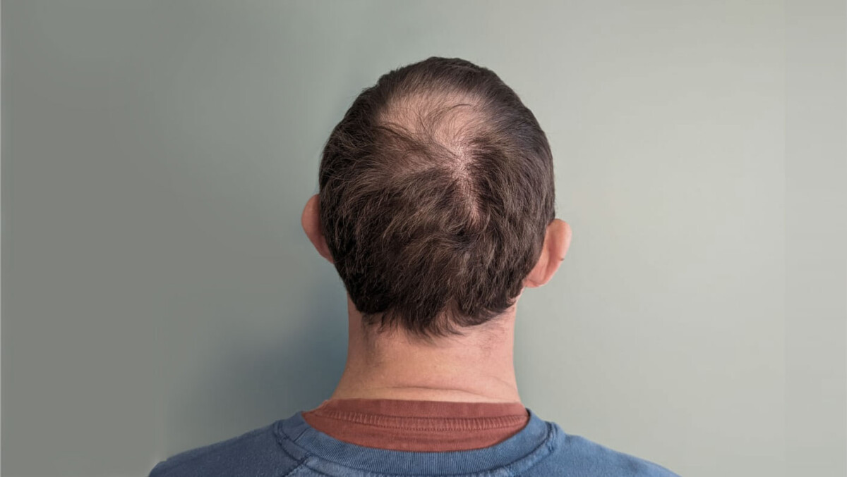 Before image